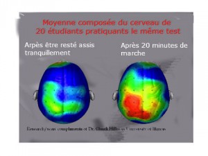 cerveau1