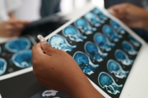 neuroplasticité cerveau en evolution
