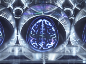 limite et defis de la neuroplasticité